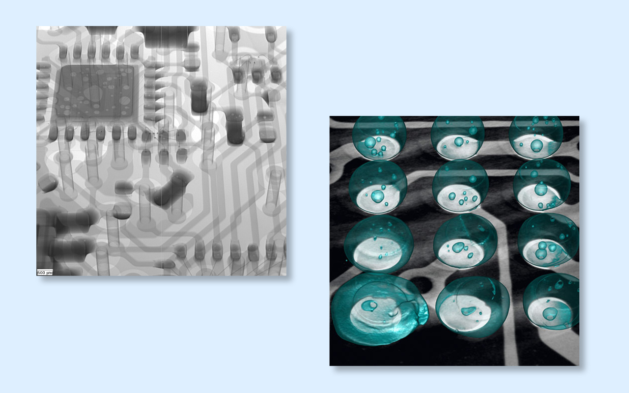 4. 2D versus 3D CT-r&ouml;ntgenfoto Welke heeft u echt nodig?